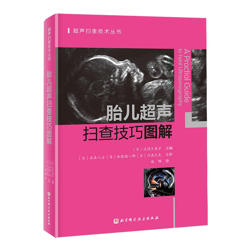 胎儿超声扫查技巧图解