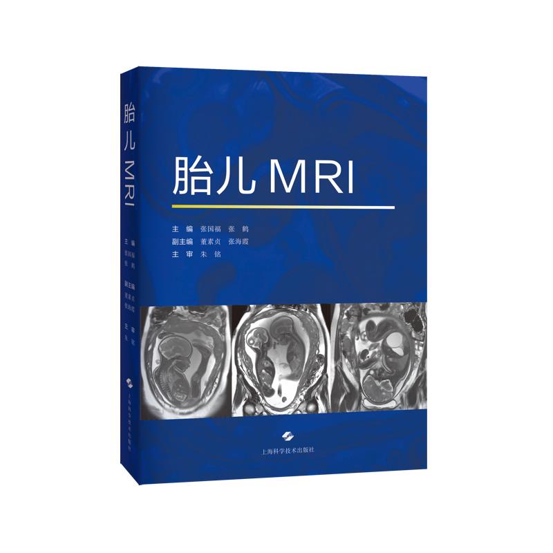 胎儿MRI