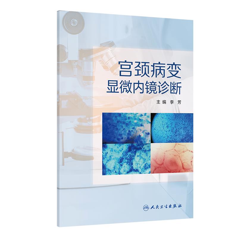 宫颈病变显微内镜诊断