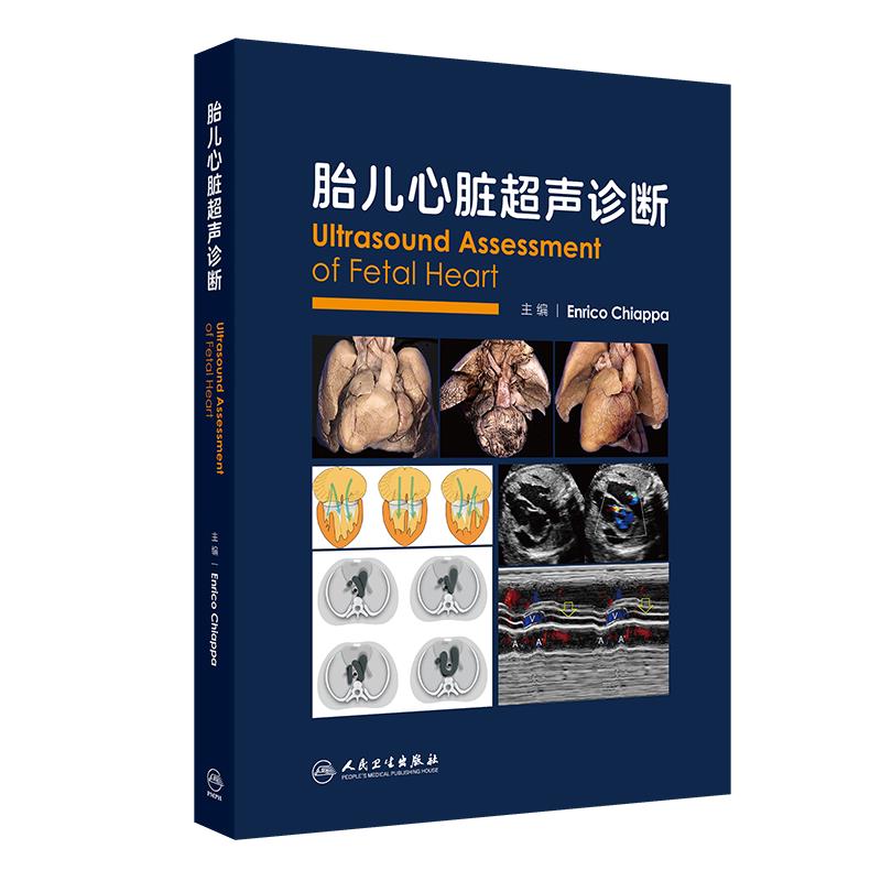 胎儿心脏超声诊断