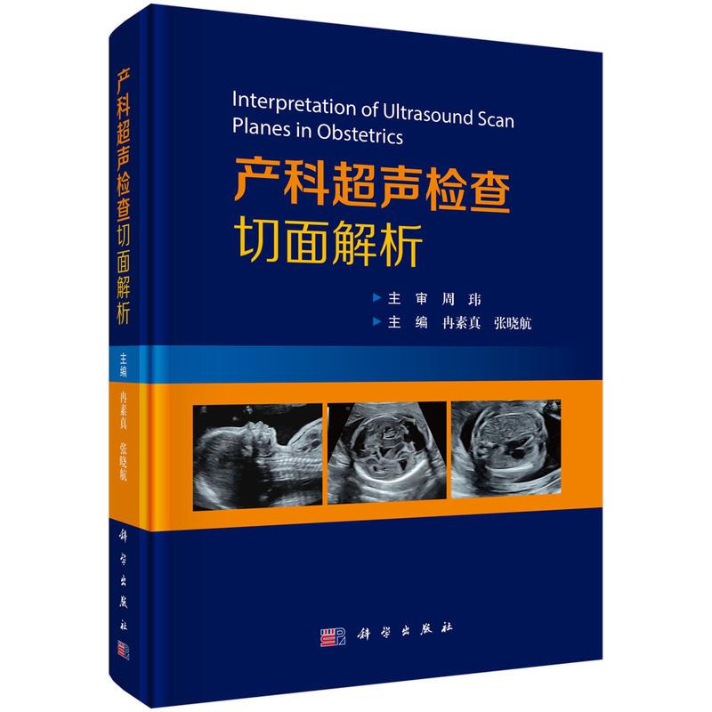 产科超声检查切面解析